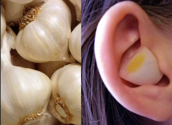 فوائد الثوم في الأذن للقضاء علي الامراض