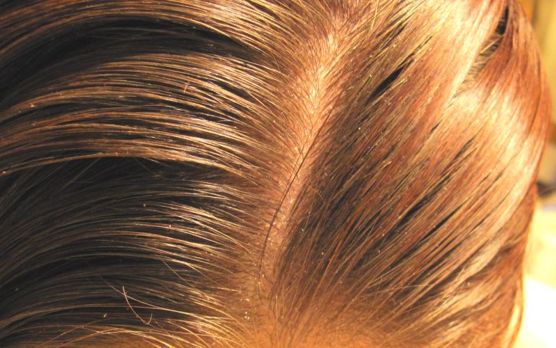طريقة صبغ الشعر بالكركم بملعقة واحدة غيري لون شعرك